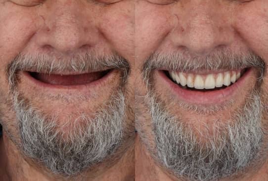 Slider image (1) The Dental Corner